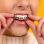 Jak często ortodonta przy aparacie?