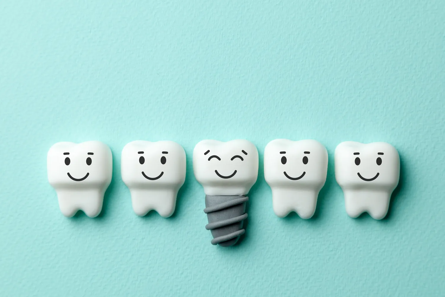 Co trzeba wiedzieć o implantach zębowych?