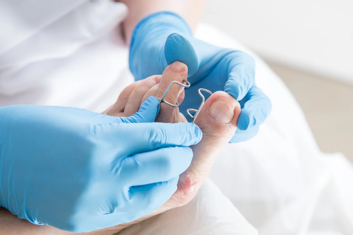 Podologia - medycyna czy kosmetyka?